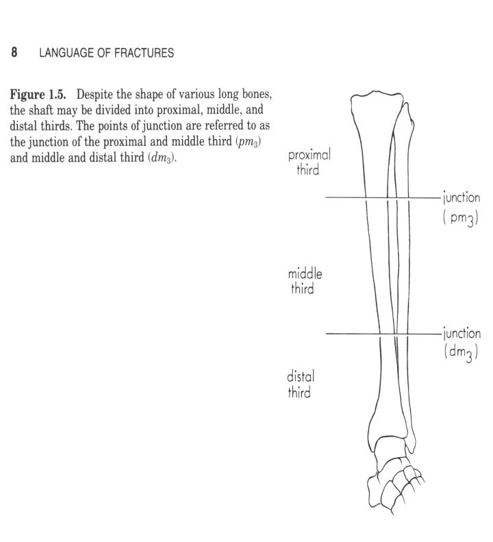 bayonet apposition fracture